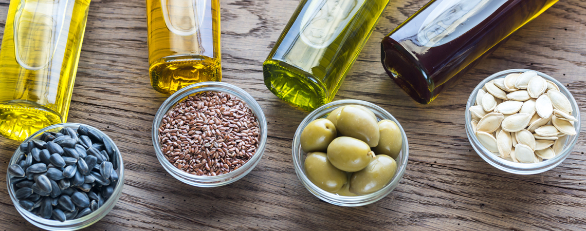 Fünf Ölflaschen liegen neben kleinen Schalen mit Samen und Oliven.